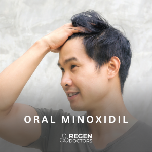 Oral Minoxidil